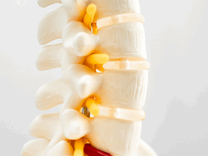 discseel procedure to regrow spinal discs