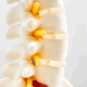 discseel procedure to regrow spinal discs
