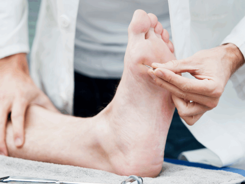 HFX Spinal cord stimulation for diabetic neuropathy