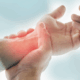 living with fibromyalgia