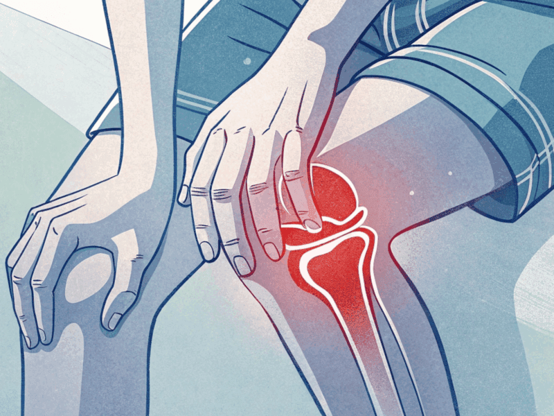 osteoarthritis and soft tissue injuries